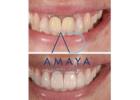 Best Dental Clinic in Bangalore | Top Dentist Bangalore