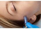 Minimal Downtime Lasers Orlando