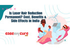 Get Smooth Skin with Laser Hair Removal in Delhi | Book at EaseMyCure