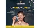 Trusted Dental, Skin, and Cancer Care Clinic in Jakkur - Oncodermacentre.com