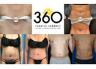 360 Plastic Surgery