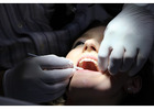 Wisdom Teeth Removal Cost Guide for Safe and Affordable Care