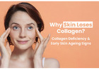 Collagen Loss