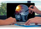 Why Patients Trust Brain Tumor Center Gandhinagar for Brain Care
