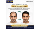Hair Transplant Clinic Doddathoguru – Personalized Hair Restoration Care | Clarivskin.in