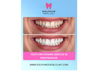 Professional Teeth Whitening Service in Madinaguda – Brighten Your Smile Naturally