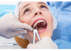Tooth Extraction in Abbotsford | Safe & Comfortable Dental Care