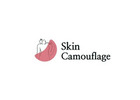 Skin Camouflage